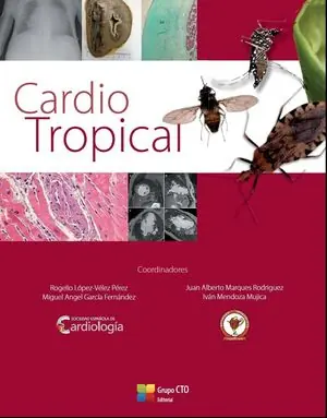 CARDIO TROPICAL Neu