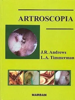 Abverkauf ARTROSCOPÍA