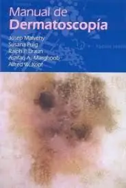 Neue Ware MANUAL DE DERMATOSCOPIA
