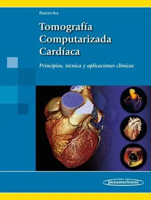 Exklusiv TOMOGRAFIA COMPUTARIZADA CARDIACA. PRINCIPIOS, TÉCNICA Y APLICACIONES CLÍNICAS
