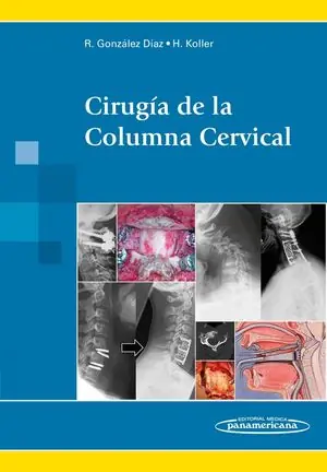 GONZALEZ:CIRUG?A COLUMNA CERVICAL Knallerangebot