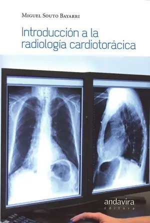 INTRODUCCION A LA RADIOLOGIA CARDIOTORACICA Begrenztes Angebot
