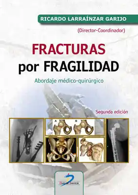 FRACTURAS POR FRAGILIDAD:ABORDAJE MEDICO QUIRURGICO Sonderangebot